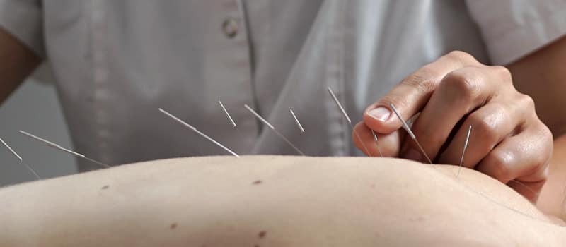 curso acupuntura escuela mans